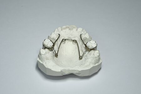 Dentures and various elements of a dental prosthesis for dentists and dental prostheses.