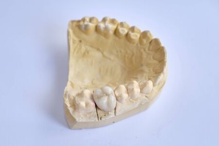 Dentistry and dental prosthetics devices