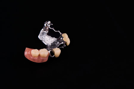 A closeup image showing a denture against a black background