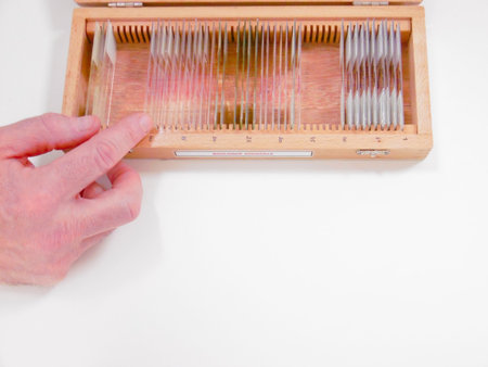 Technician Handling Glass Slide Carefully, Precision Handling Of Slides In Clinical Laboratory...