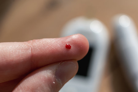 Woman pricking her finger to check blood glucose level with glucometer, test blood glucose for diabetesの写真素材