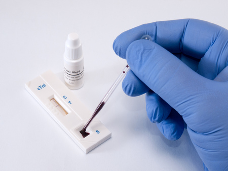Test, troponin, on heart attack of the myocardium for diagnostics in laboratoryの写真素材