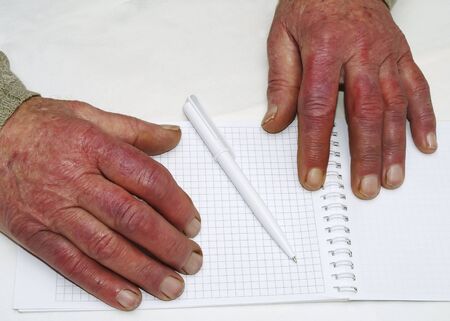 Closeup of the wrinkled hands of an old caucasian man holding pen and paper, wearing a green sweater