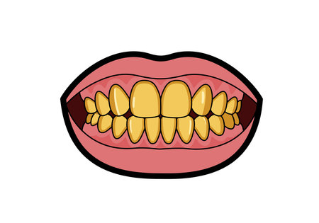 Gold teeth clipart. This image shows a mouth with gold-colored teeth. Vector illustration design.のイラスト素材