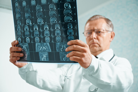 Older man doctor is analyzing MRI image of human head in hospitalの写真素材