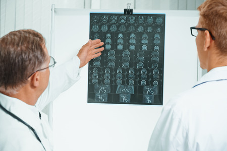 Senior doctor examines MRI image of human head. Senior doctor teaches young doctorの写真素材