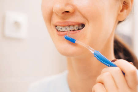 Young woman with braces on her teeth brushing her teeth with a special dental brush, close-up.の写真素材