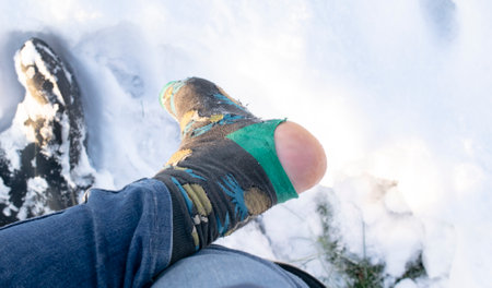 a hole in the sock, the leg of a manual workerの写真素材