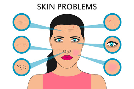 Female face skin problems. Acne and pimples, black spots, redness, dryness, circles under the eyes and wrinkles. Vector illustration for cosmetic brochure or banner, poster.のイラスト素材