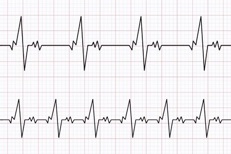 Heartbeats cardiogram. ECG heart line. Electrocardiogram paper background. Vector illustration.のイラスト素材