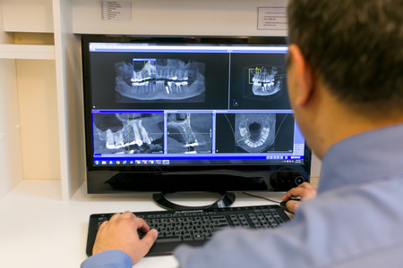 Technician Looking at X-Rays on a Computer Screen