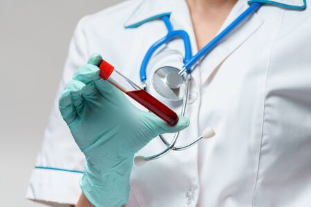 medical doctor nurse woman wearing protective mask and gloves - holding virus blood test