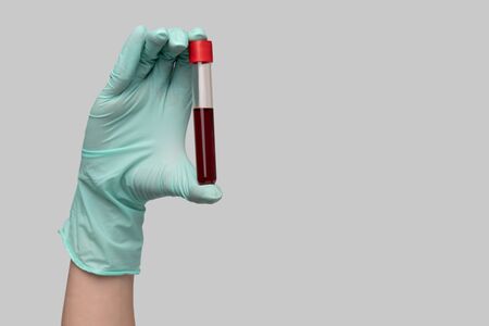 hand holding blood in test tube close up over light gray backgroundの写真素材