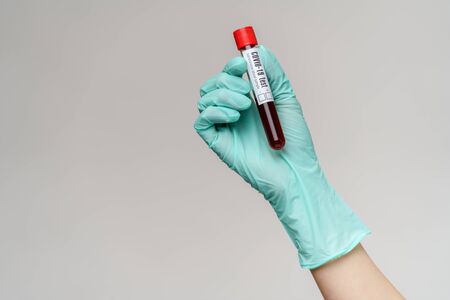 hand in latex glove holding blood in test tube close upの写真素材