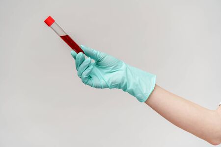 hand in latex glove holding blood in test tube close up