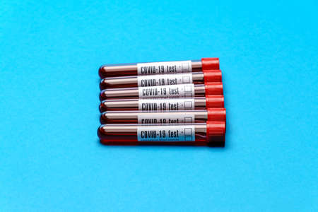 top view of medicine test tubes with blood samples over blue backgroundの写真素材