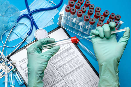 lab technician assistant or doctor wearing rubber or latex gloves holding blood test tube and...