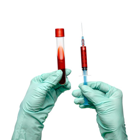 hand in latex glove holding blood sample in test tube and syringe close up isolated on white backgroundの写真素材
