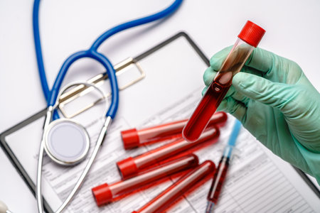 lab technician assistant or doctor wearing rubber or latex gloves holding blood test tube over clipboard with blank formの写真素材
