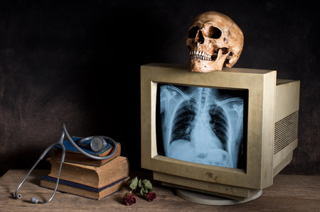 Still life photography, human skull with X-ray image of human spine and breastbone in monitorの写真素材