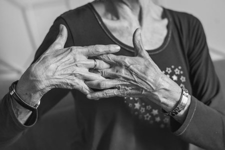 80 year old woman hands with osteoarthritis, swollen hands and fingers, joint inflammation, due to...