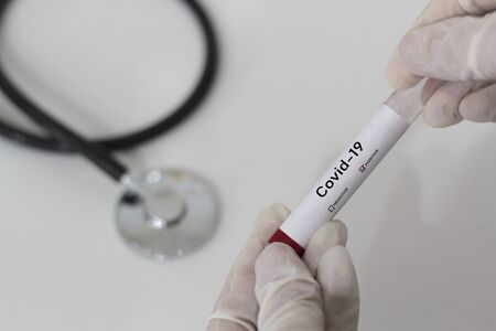 Positive blood test for COVID-19 virus with medical stethoscope on the backgroundの写真素材