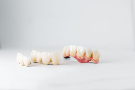 Close-up on dental crowns on the white background. Concept of prosthetics and implantation in...