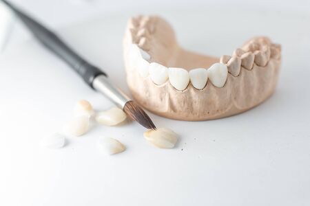 Close-up on plaster model of artificial jaw with teeth and paintbrush on the white background. Concept of art in aesthetic dentistryの写真素材
