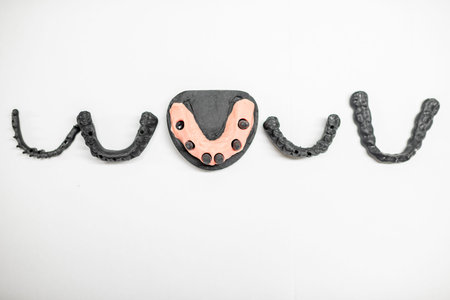 Artificial jaw with crowns and frame for dental implants on the white background, flat lay...