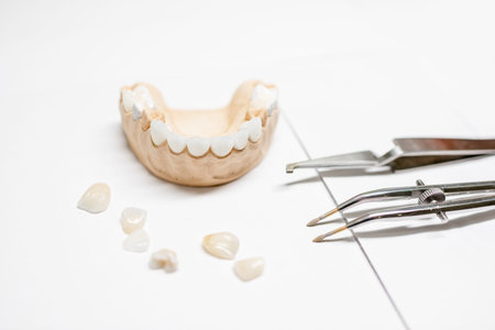 Artificial plaster jaw model with veneers and dental instruments on the white background. Concept of...