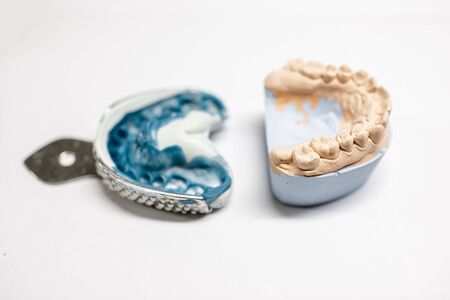 Artificial plaster jaw model with impression on the white background. Manufacture of molds for dentures in laboratoryの写真素材