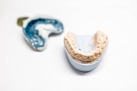 Artificial plaster jaw model with impression on the white background. Manufacture of molds for dentures in laboratoryの写真素材
