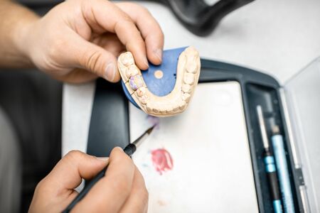 Dental technician coloring dental prosthesis with a paint brush at the laboratory, close-up view. Concept of implantats producingの写真素材