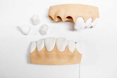 Close-up on a plaster models of jaw fragment with teeth on the white background
