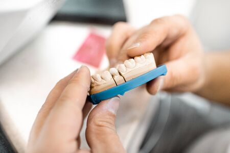 Dental technician working on gypsum jaw, placing implant crown into the artificial jaw at the laboratory, close-up viewの写真素材