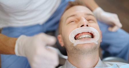 Patient with dental braces during an orthodontic treatment