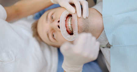 Patient with dental braces during an orthodontic treatmentの写真素材