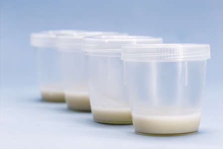 sperm collector vials and containers, semen donation concept, copyspace for textの写真素材