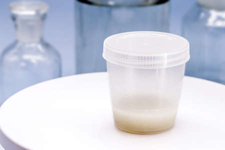sample collection container, with semen for sperm culture, to detect the presence of pathogensの写真素材