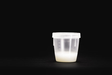 collection bottle or sample container with male semen for sperm analysis