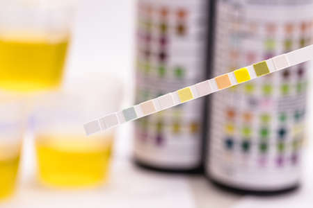 reagent strips used in urinalysis to analyze Leukocytes, Urobilinogen, Bilirubin, Blood, Nitrite, pH, Density, Protein, Glucose and Ketosis bodies.の写真素材
