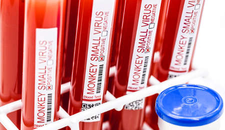 monkeypox contaminated blood test, smallpox test result indicating positive, contaminationの写真素材
