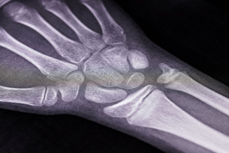 x-ray of the hands, detail of the phalanges and joints,trapeze,scaphoid,Pyramidal,Pisiform,capitate, distal, frontal, proximal, interflaginian, lunate, intercapitateの写真素材