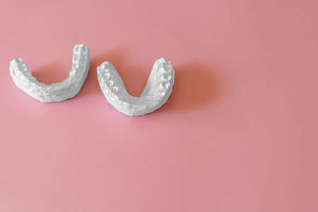 Plaster casts for aligners, gypsum model plaster for teeth. Dental mold on pink background. Tooth cast for invisible braces, aligner or night guard for bruxism. Human jawの写真素材