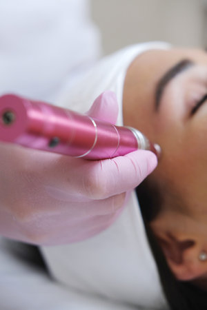 Cosmetic Professional Using a Dermaroller Deviceの写真素材