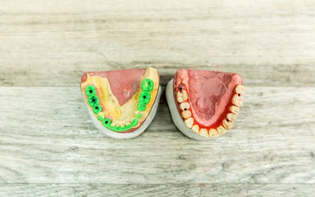 Close-up view of dental molds used in prosthetic dentistry, showing intricate details and...
