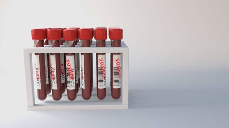 group of test tubes of infected blood on white backgroundの写真素材