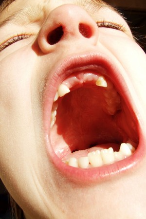 A boy opens wide his mouth. You can see a gapの写真素材