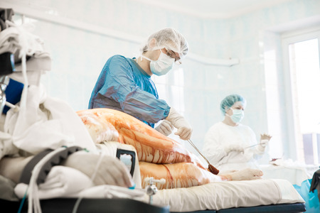 some surgeons  doing difficult operation in hospitalの写真素材
