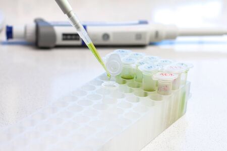 Clinical laboratory in process of chemical analysis. Collection of probe using automatic pipette.